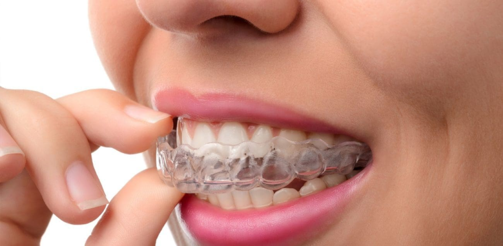 Premier Invisalign Provider