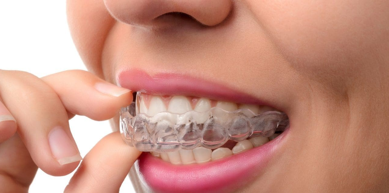 Premier Invisalign Provider