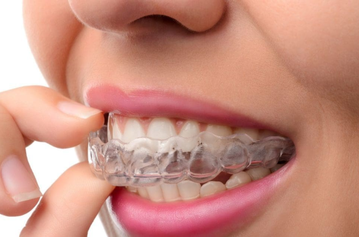 Premier Invisalign Provider